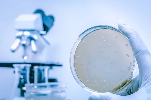 Agar Plate Full Of micro Bacterias Microorganisms